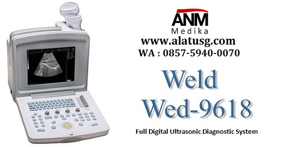 USG laptop untuk klinik dan rumah sakit bersalin  Distributor-alat-usg-4-dimensi-color-doppler1
