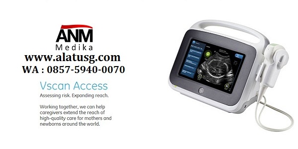 USG laptop untuk klinik dan rumah sakit bersalin  Distributor-alat-usg-abdomen1