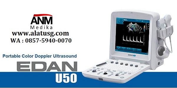 Harga USG 2d untuk pemeriksaan ANC, Abdomen, Cardio, Musculosceletal Distributor-alat-usg-portable